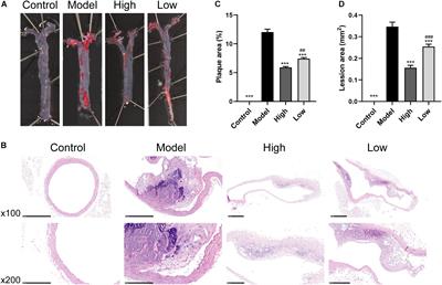 Effect of Berberine on Atherosclerosis and Gut Microbiota Modulation and Their Correlation in High-Fat Diet-Fed ApoE−/− Mice